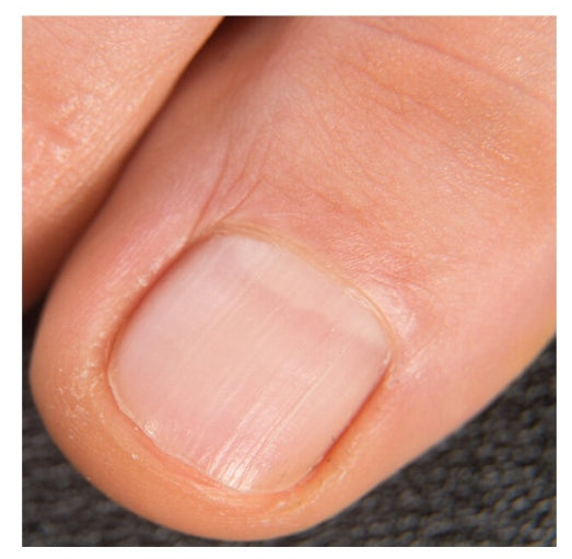 GOLMAR- Lozione Concentrata Dermo-Ungueale Onico Protettiva GolmarDerm 15ml